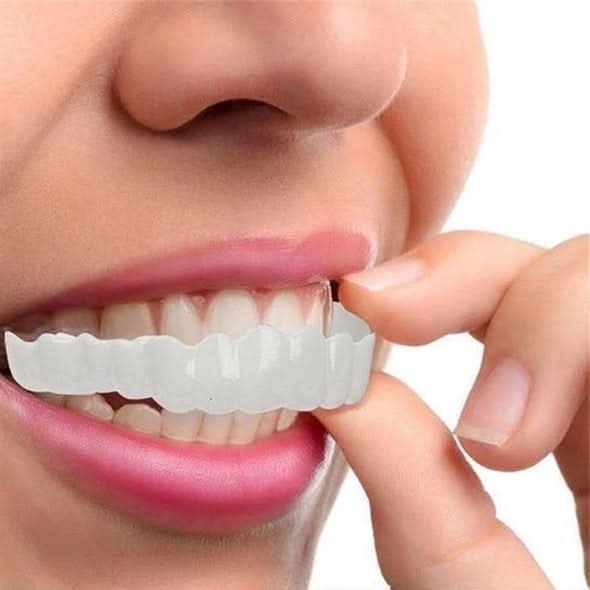 SMILEDURA – Σετ Άνω και Κάτω Όψεων Χαμόγελου