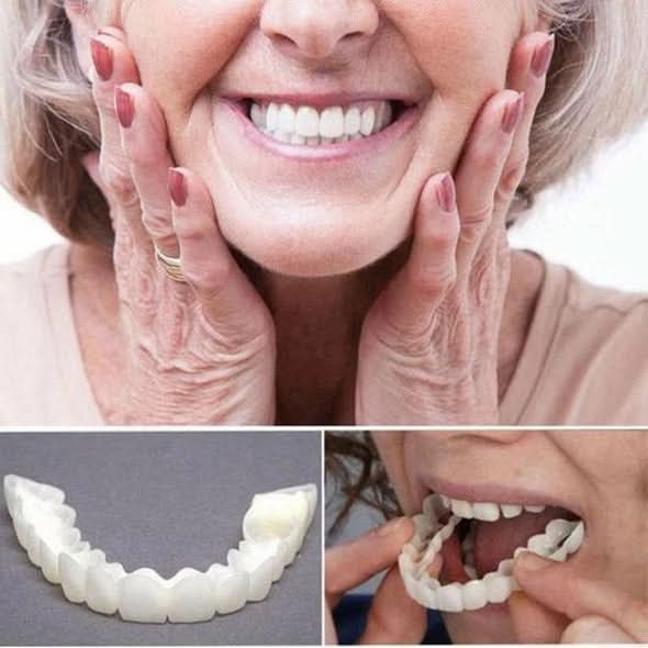 SMILEDURA – Σετ Άνω και Κάτω Όψεων Χαμόγελου