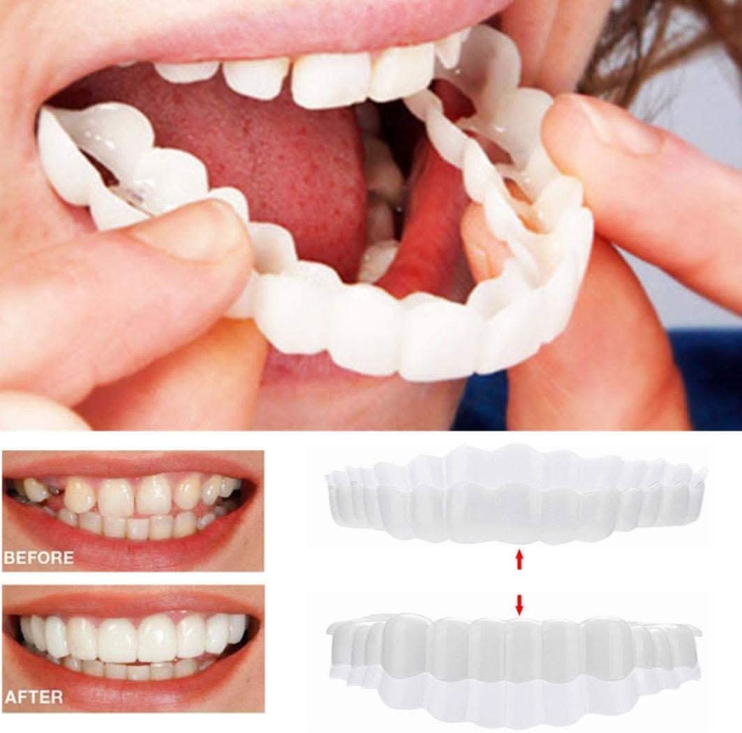 SMILEDURA – Σετ Άνω και Κάτω Όψεων Χαμόγελου