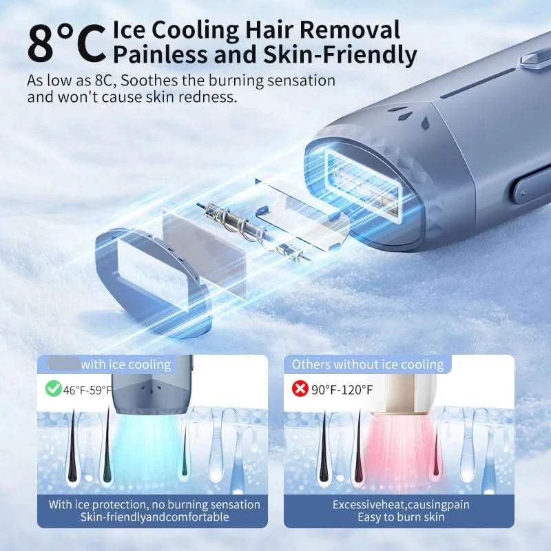 FROSTLUME – Dispositivo di Depilazione Rinfrescante per Uso Domestico Confortevole